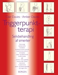 Triggerpunkt-terapi