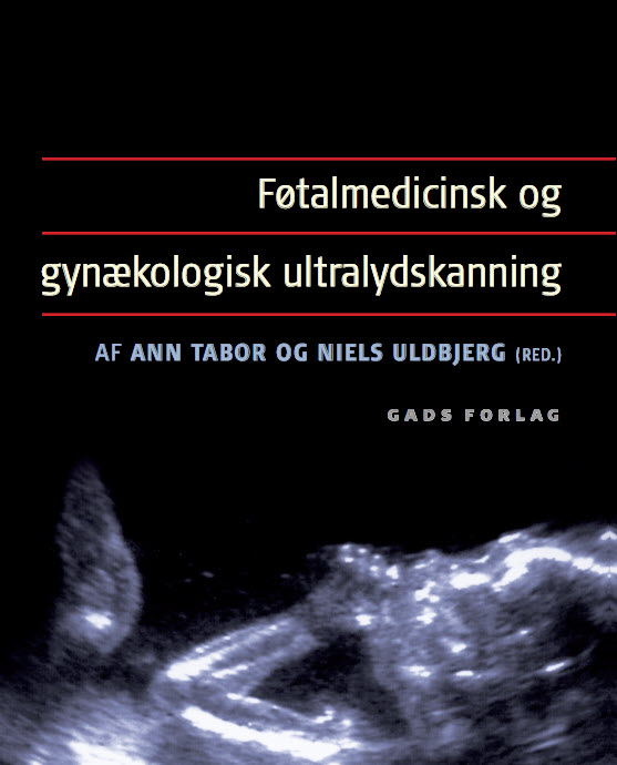 Føtalmedicinsk og gynækologisk ultralydskanning